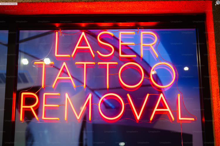 How To Find The Best Laser Tattoo Removal Clinic